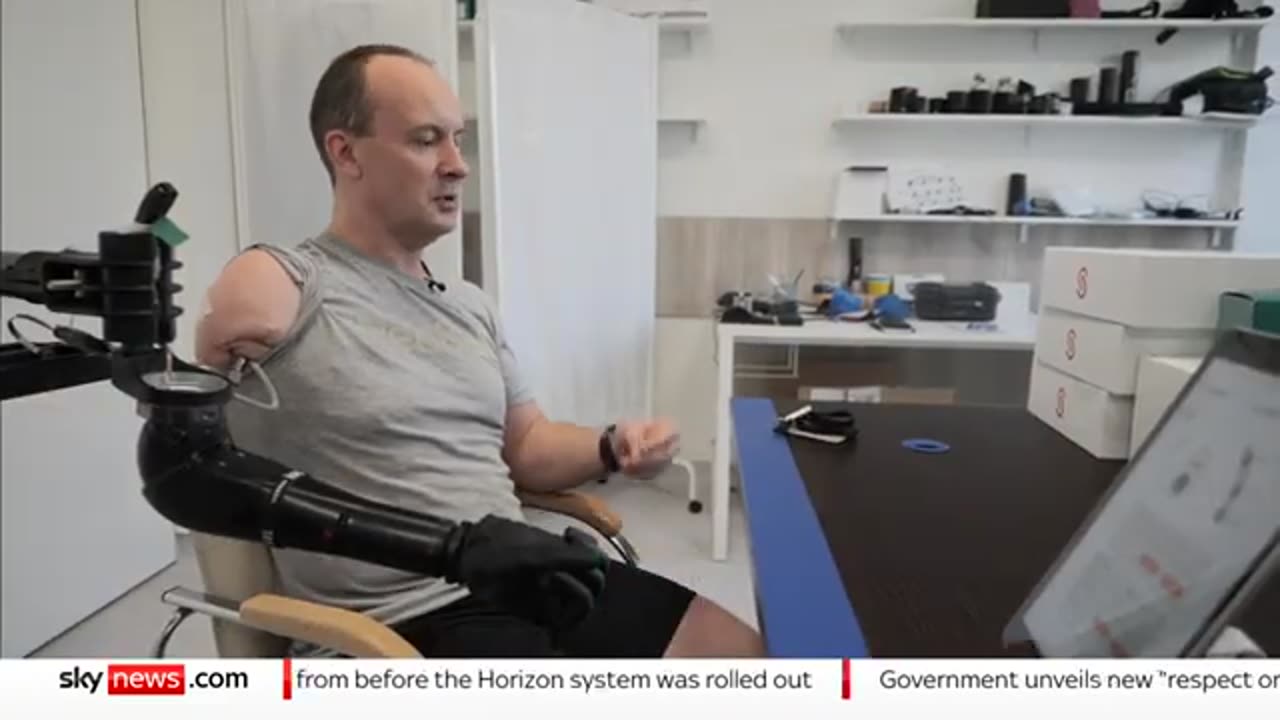 Ukraine war_ How bionic limbs are helping Ukrainian troops injured in the war