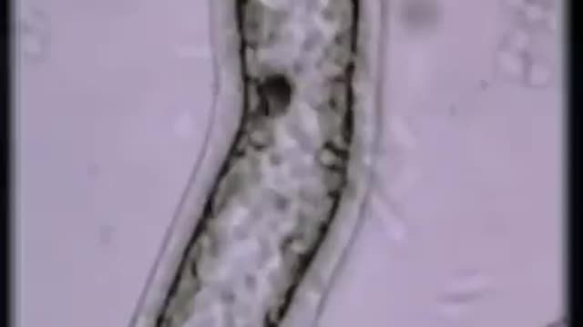 Cell sized robots‼️Also found in the new covid vaccines