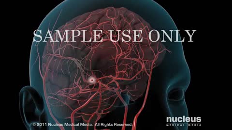 Stroke Nucleus Health