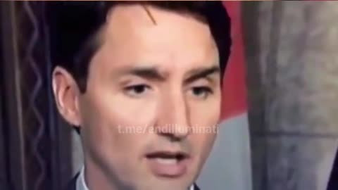 Did Justin Trudeau Lose An Eyebrow?