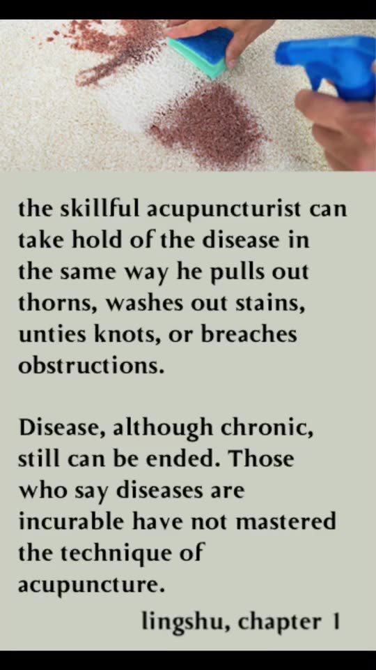 how is your acupuncture?