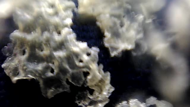 Dandruff close-up ASMR Satisfying