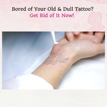 Bored Of Your Old & Dull Tattoo? Get Rid Of It Now!