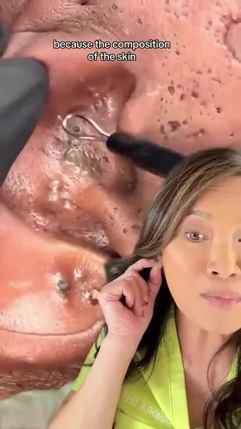 ＂Matching＂ Ear Skin (@minkology101skincare )