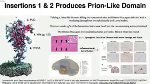 Children Notice Memory Loss in Their 'Covid Vaccinated' Parents (Prion Disease is Discussed)