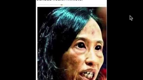 USA CANADA HIRE MENTALLY ILL UNHEALTHY HEALTH MINISTERS RACHEL LEVINE THERESA TAM