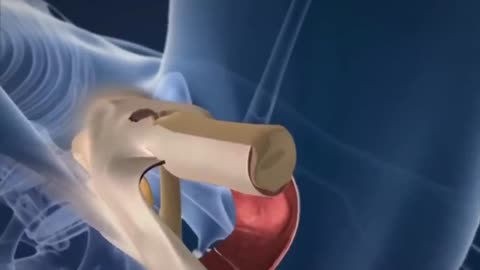 3D Animation of a Sexual Reassignment Surgery [Male to Female]