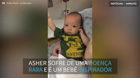 Após 3 cirurgias, bebê com doença rara mostra muque para mãe