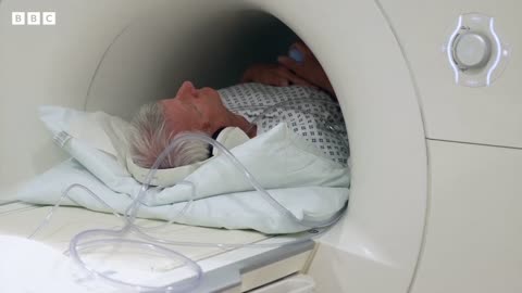 Can MRI scans screen men for prostate cancer? - BBC News