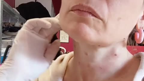 BAP Mapping For The Neck