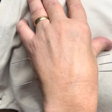 embrace life fully with acupuncture