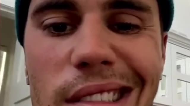 Justin Bieber appears in video with his face paralyzed and shocks his fans