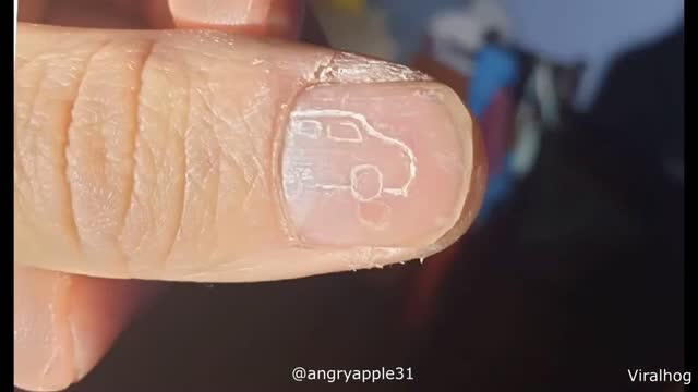 Car in Finger...