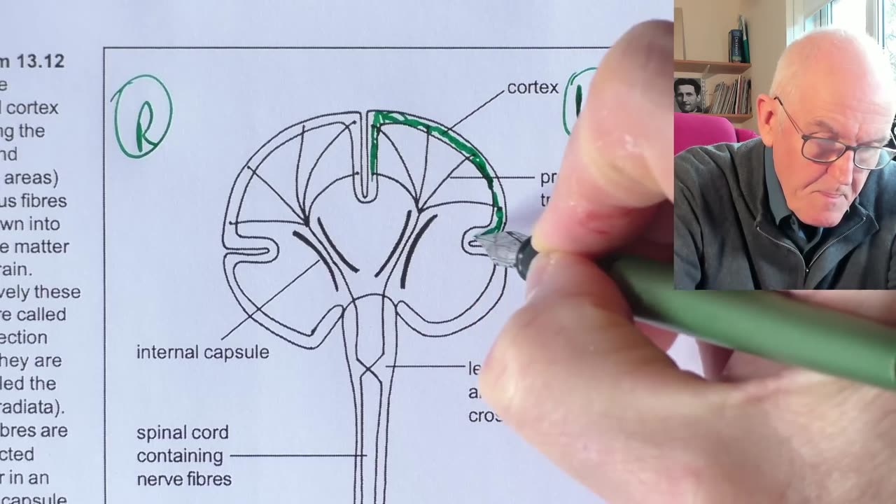 Dr John Campbell: Stroke - 21 Nov 2024