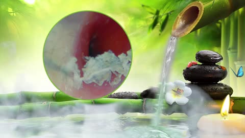Earwax Cleaning With Relaxing Sound Part-7