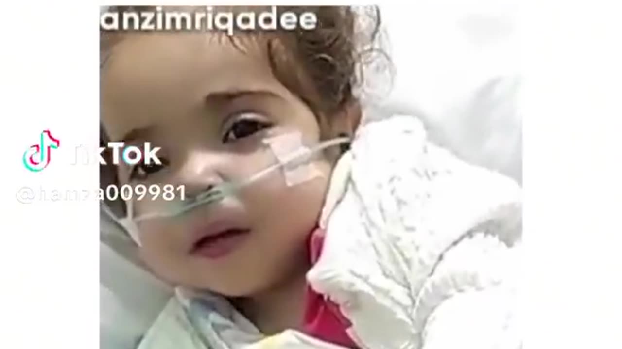 Palestini's Small Baby damage and in Israel attack