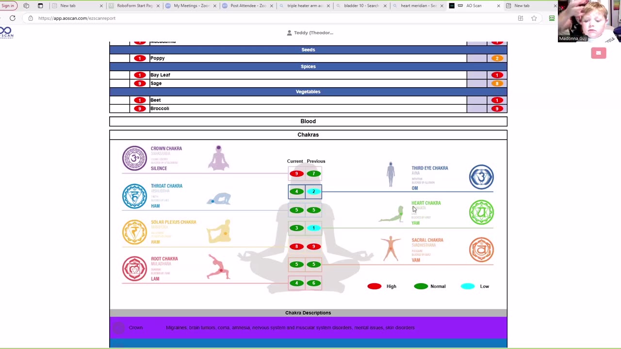 Teddy & Madonna chatting about BioResonance & the AOHub - regrow those brain neurons!!