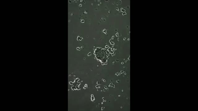Things That Will Shock You If You See Under A Microscope