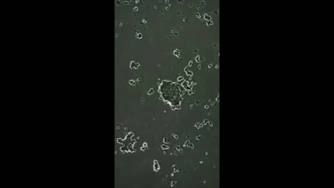 Things That Will Shock You If You See Under A Microscope