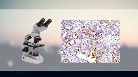 Immunohistochemistry /Immunofluorescence