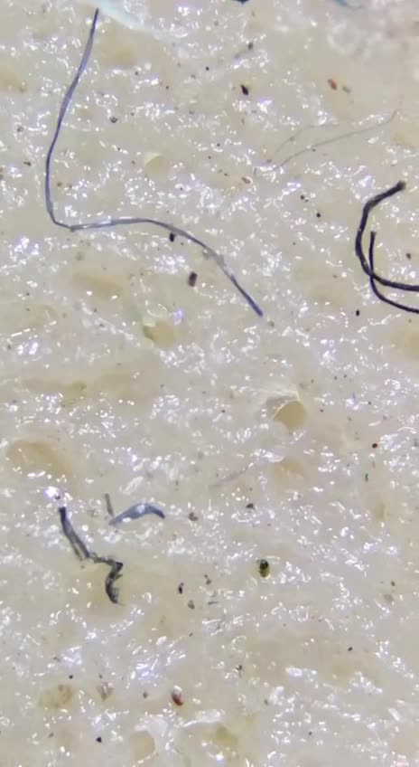 Hot Dog 🌭 Parasites & Microplastics