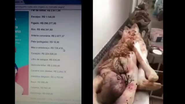 # Covid19 fucionarios beat the man to death, in the medical report says he died of covid 19.#Videos