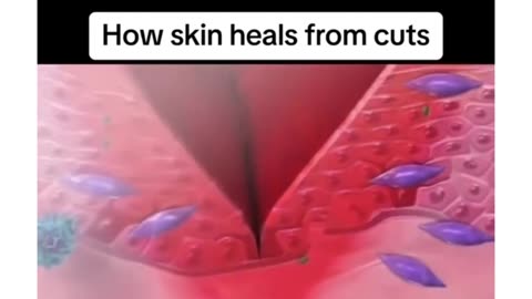 How skin heals from cuts