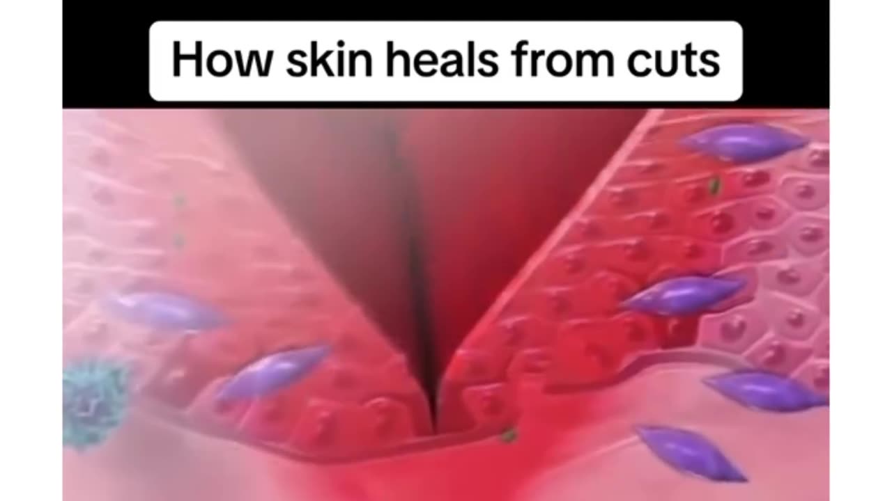 How skin heals from cuts