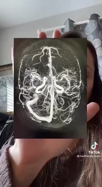 A female vaccinated three times by Pfizer displays x-rays of her brain after the third dose.