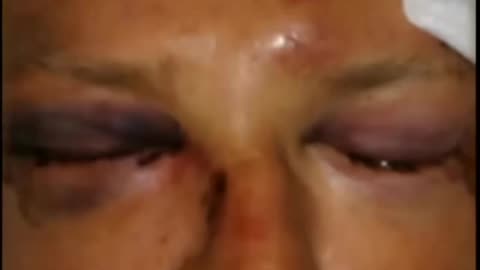 White family attacked for being in wrong neighborhood, not a hate crime