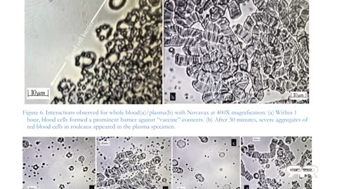 Self-Assembly Nanobots in the COVID-19 Injectables - Reese Report