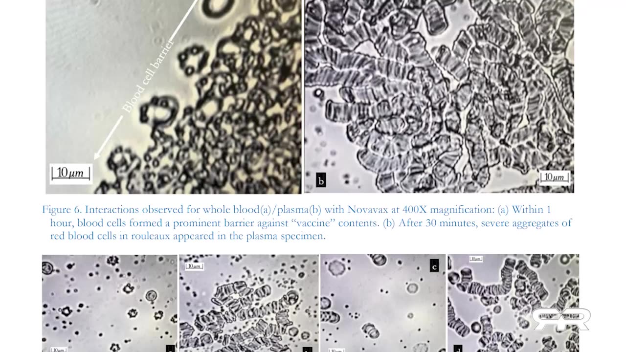 Self-Assembly Nanobots in the COVID-19 Injectables - Reese Report