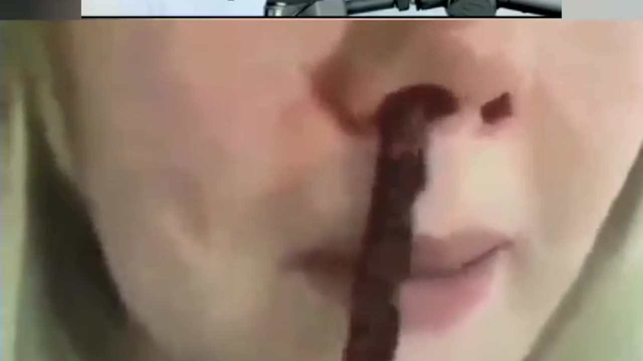 Real Incidents REPORT FROM WHO