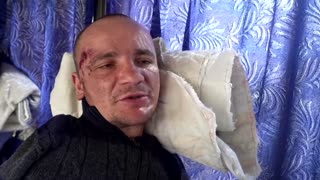 Ukrainian soldiers wounded at Mykolayiv frontline speak