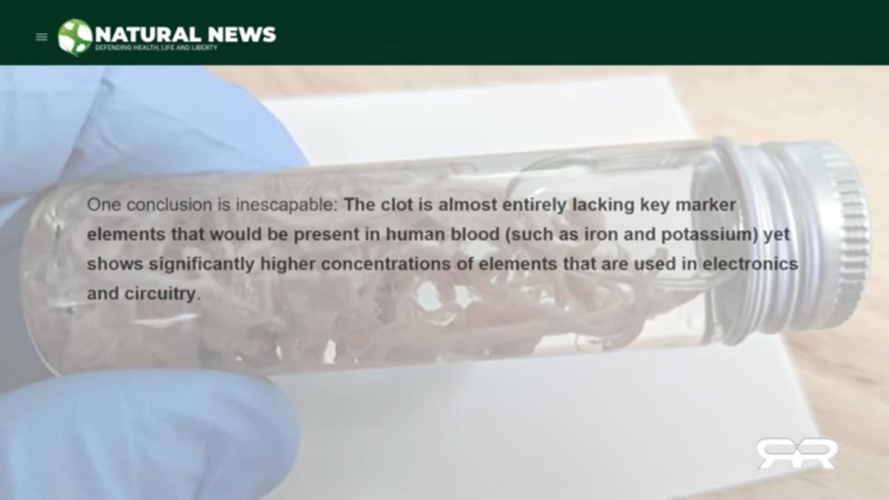 Thermographic Imaging Shows Massive Blood Clots in the CV19 Jabbed (Reese Report - May 2023)