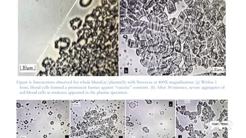 Recent Study Shows Self-Assembly Nanobots in the COVID-19 Injectables