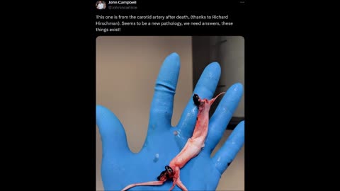 Found in the carotid artery