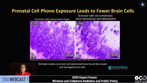 Prenatal Cell Phone Exposure Leads to Less Brain Cells in Babies