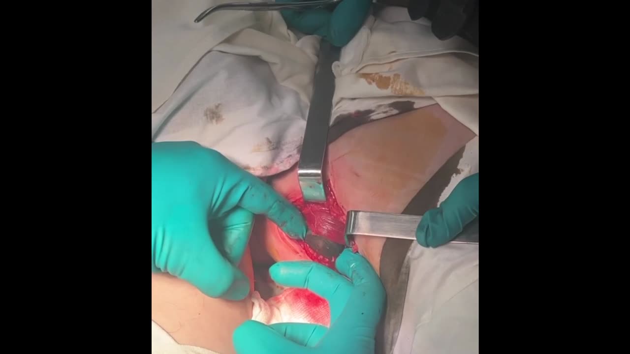 What happened today in a military hospital in Lugansk is difficult to call otherwise than a miracle.