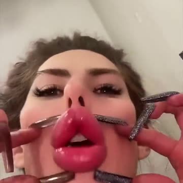 Surgery with zero euro 😅🤷_♀️ #shorts #funny #comedy