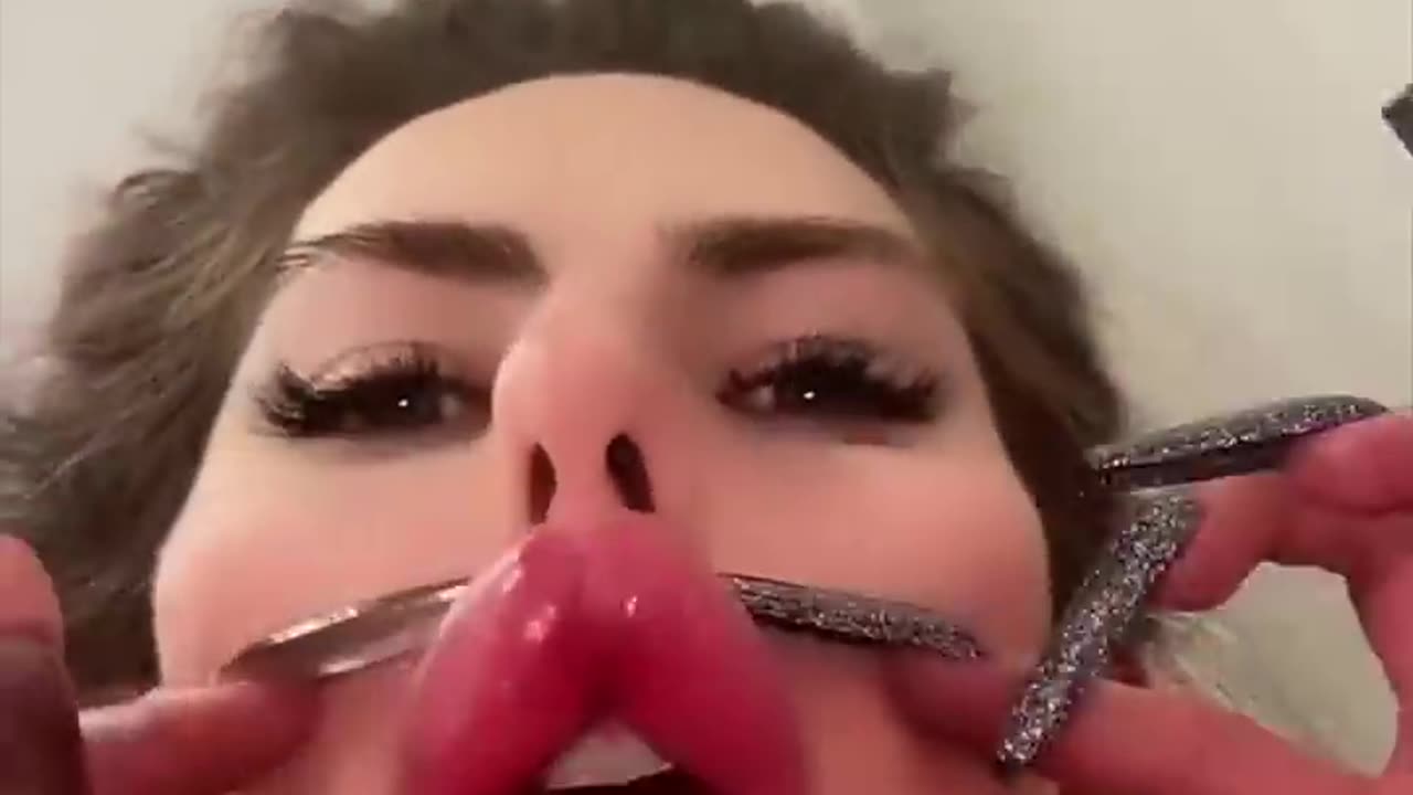 Surgery with zero euro 😅🤷_♀️ #shorts #funny #comedy