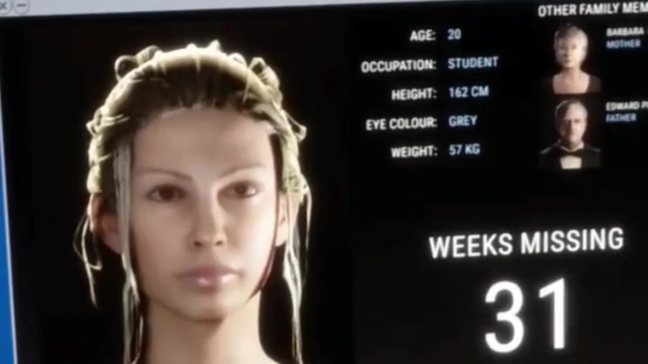 Ear Health Is IMPORTANT! #sietch_gaming #sonsoftheforest