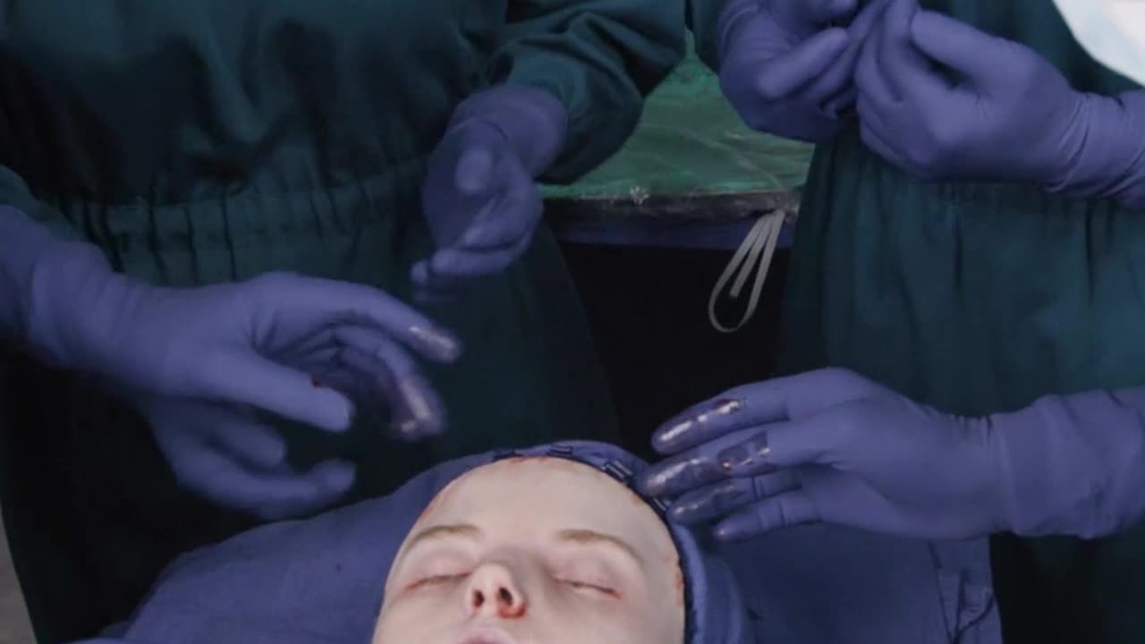 A girl is disfigured.