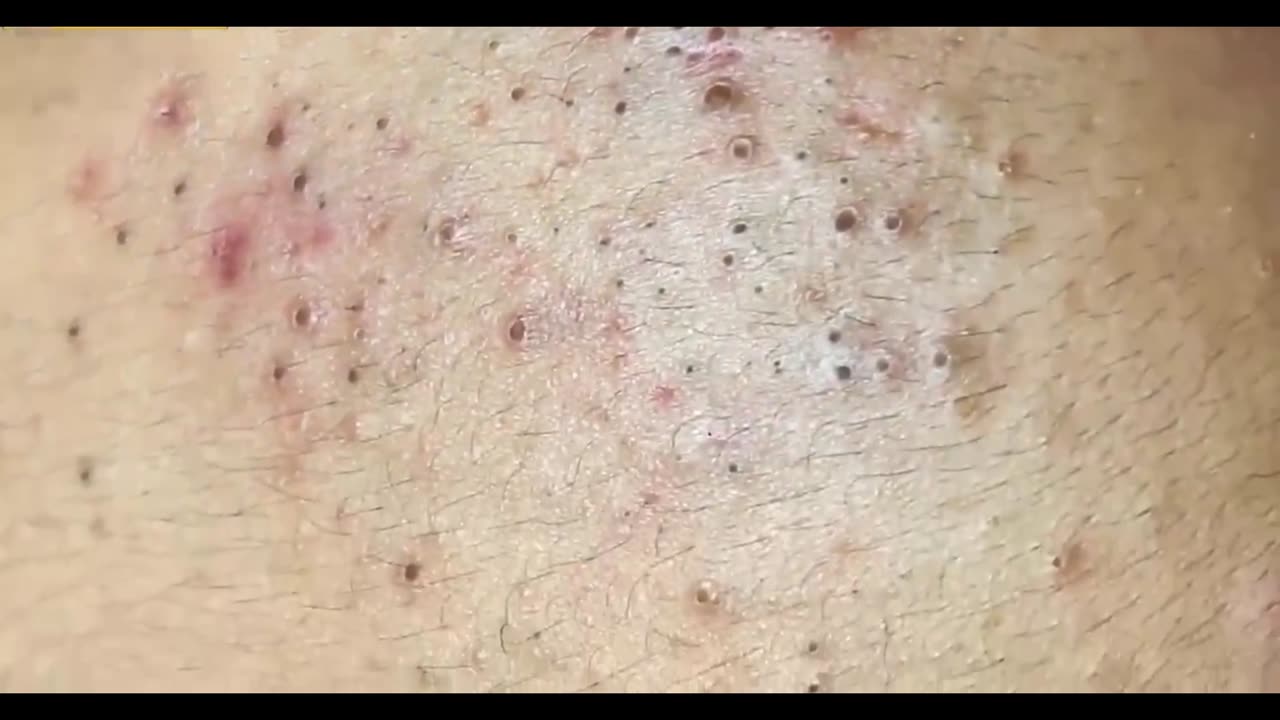 Enjoy From skin Cleaning.