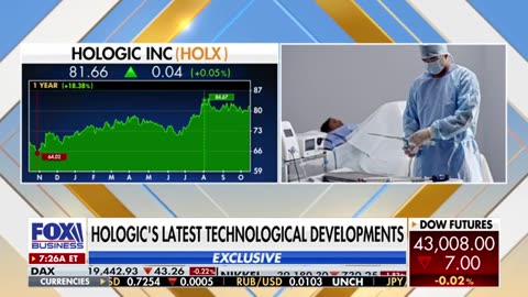 Hologic to acquire Gynesonics in $350M deal to boost Fibroid treatments