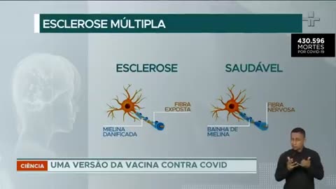 Estudo inicial mostra que a vacina da Pfizer contra a Covid-19 pode conter Esclerose Múltipla