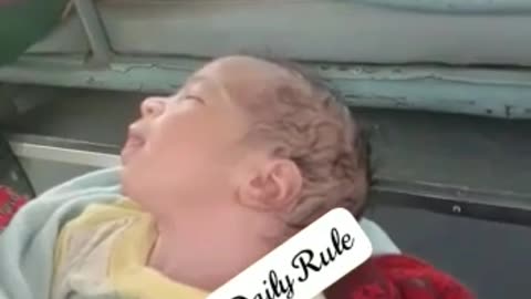 Baby have 3 eye
