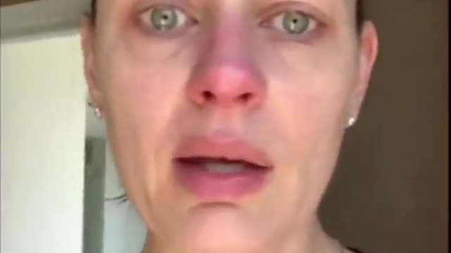 Canadian Actress Who Gets Bell's Palsy is STILL Proud to be Vaxxed