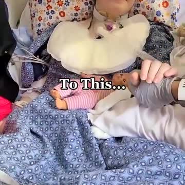 18 yr old Has 4 Strokes & 3 Brain Surgeries after Getting VAXXED