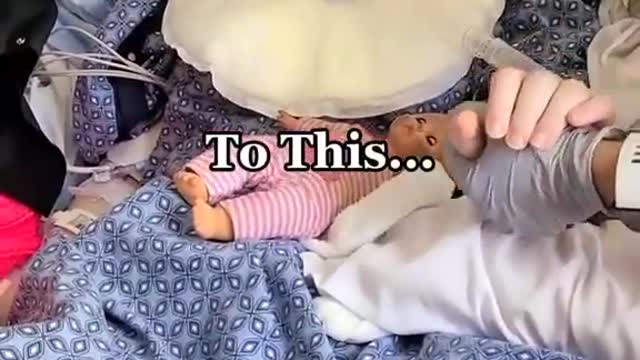 18 yr old Has 4 Strokes & 3 Brain Surgeries after Getting VAXXED